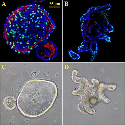 Intestinal in vitro and <mark class="highlighted">ex vivo Models</mark> to Study Host-Microbiome Interactions and Acute Stressors